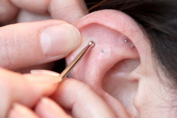 Ear seeds