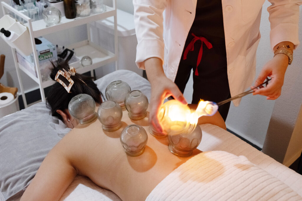 Acupuncture care