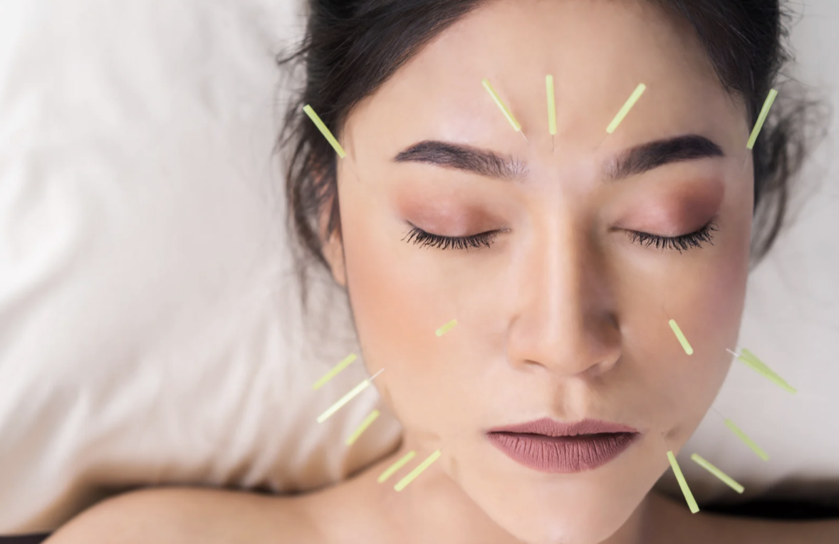Glow From Within: Facial Acupuncture, Cupping & Holistic Microneedling at TAO